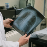 Mains tenant films radiologiques pres bac collecte
